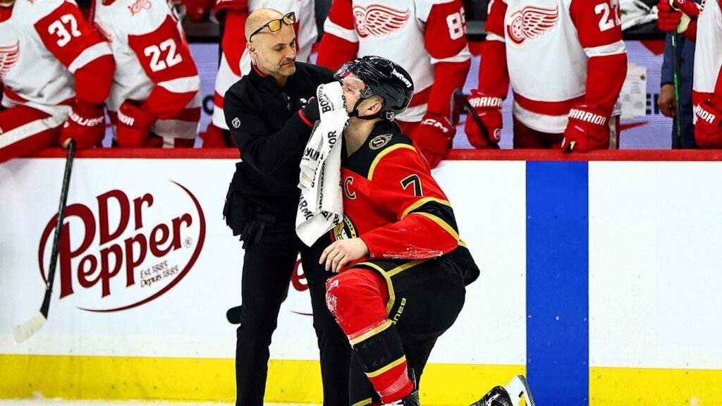 Senators’ Brady Tkachuk bloodied, gets game misconduct in return to NHL action