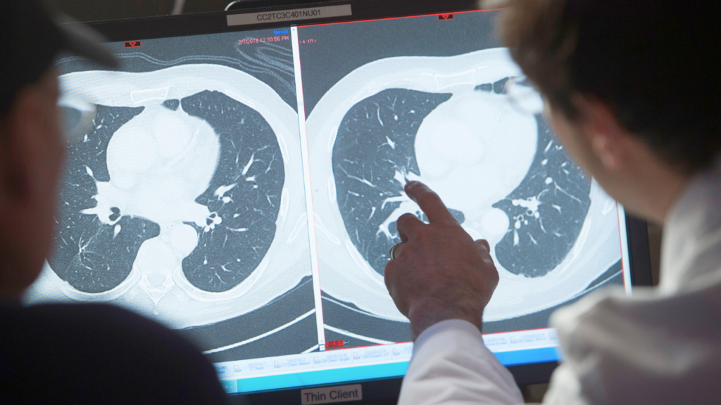 Eradicating cancer could boost the US economy by $185T, report finds