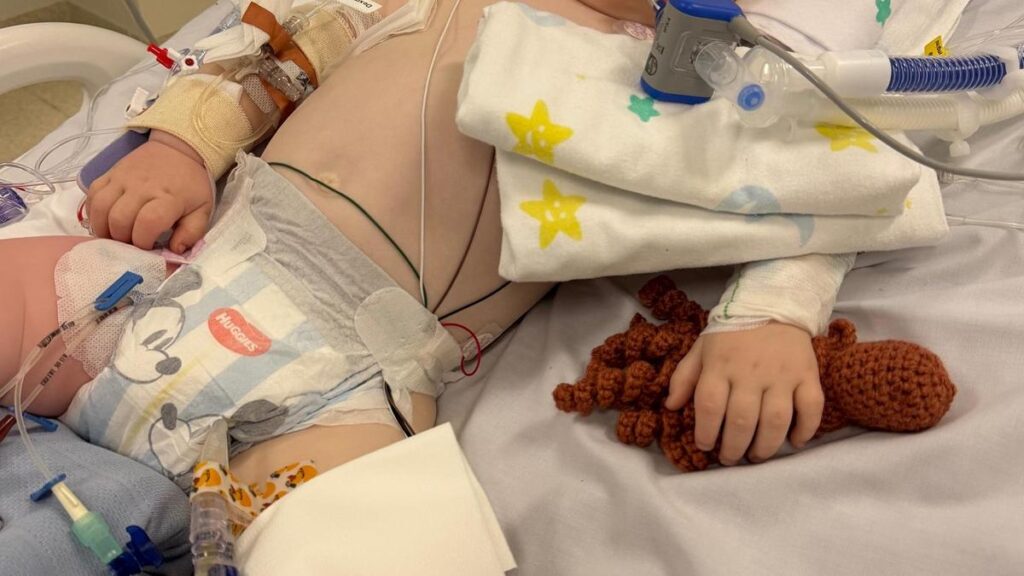 ‘Awake and alert’: Heartwarming update on Gold Coast toddler Dusty Wildman after horror baking tragedy
