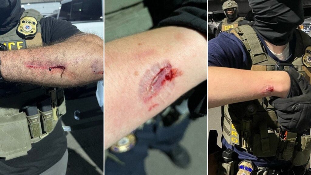DOJ charges Newark rioter with assaulting ICE officers at detention center