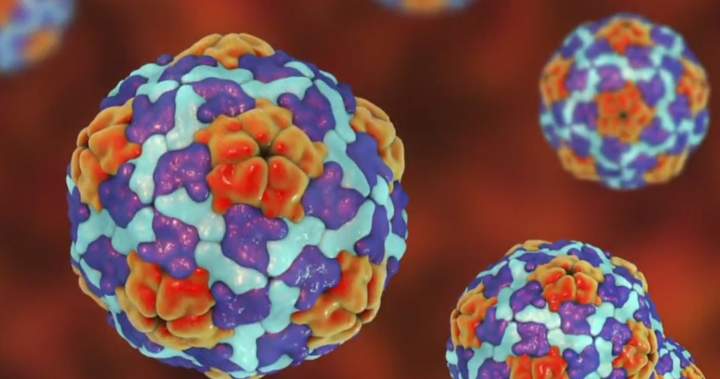 U.S. CDC travel advisory issued for Manitoba over hepatitis A outbreak