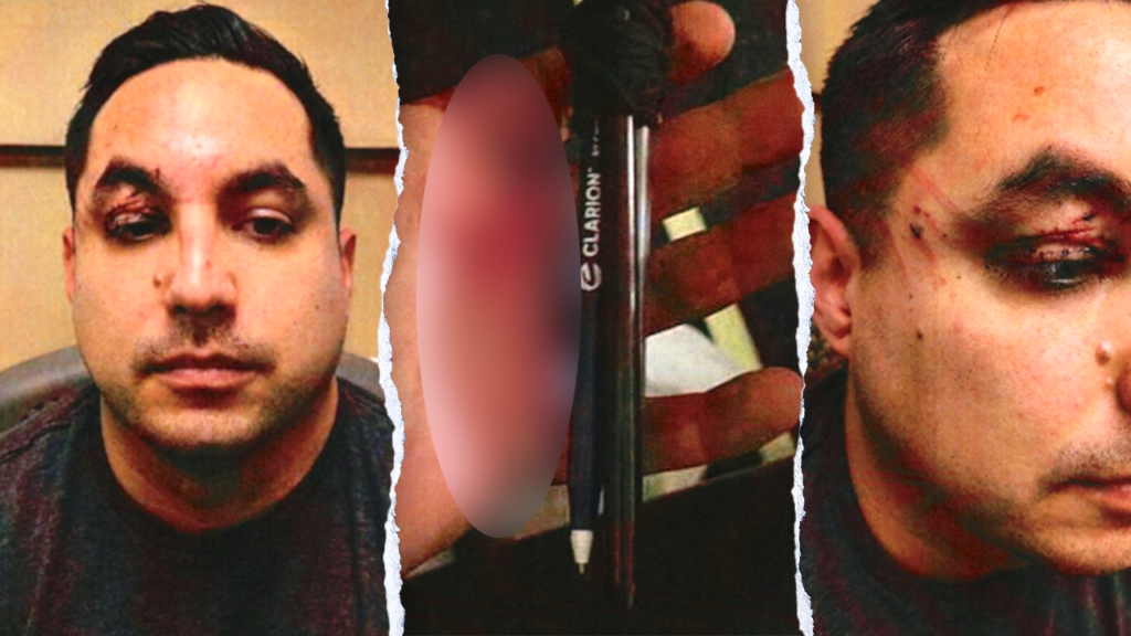 Jet passenger admits making pen weapon before bloody midair eye attack