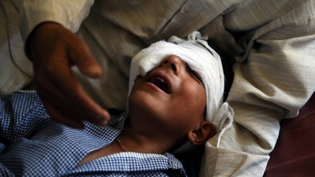 ‘Limited damage’: Upcoming Bollywood film angers Kashmir pellet gun victims | Bollywood News