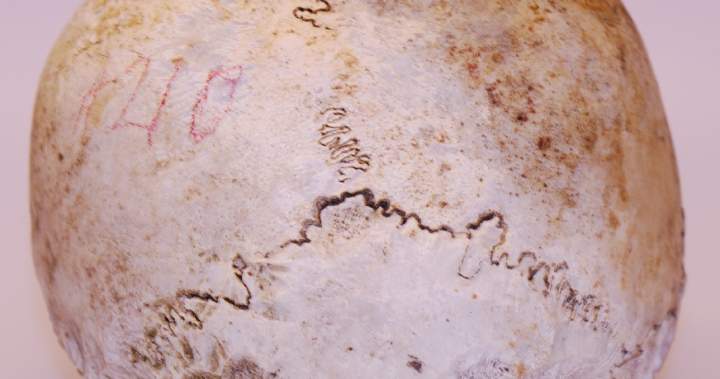 Skull found in 1975 belongs to Uxbridge, Ont. WWI veteran: police