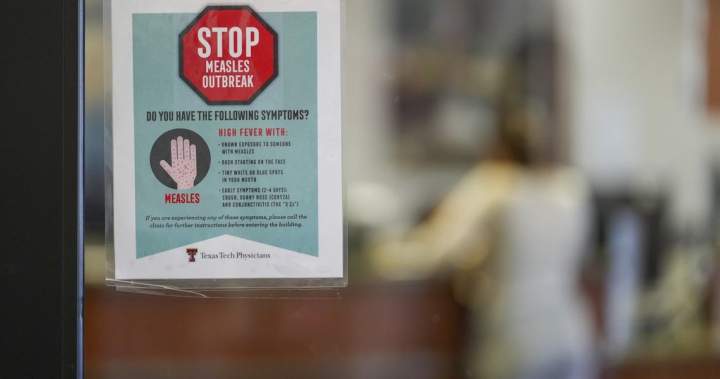 Canada’s measles cases are half of U.S. total, despite smaller population: WHO – National