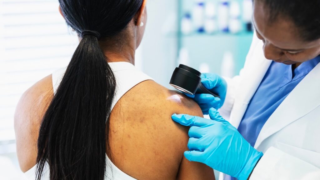 Personalized cancer vaccine stops melanoma from returning or spreading in historic trial
