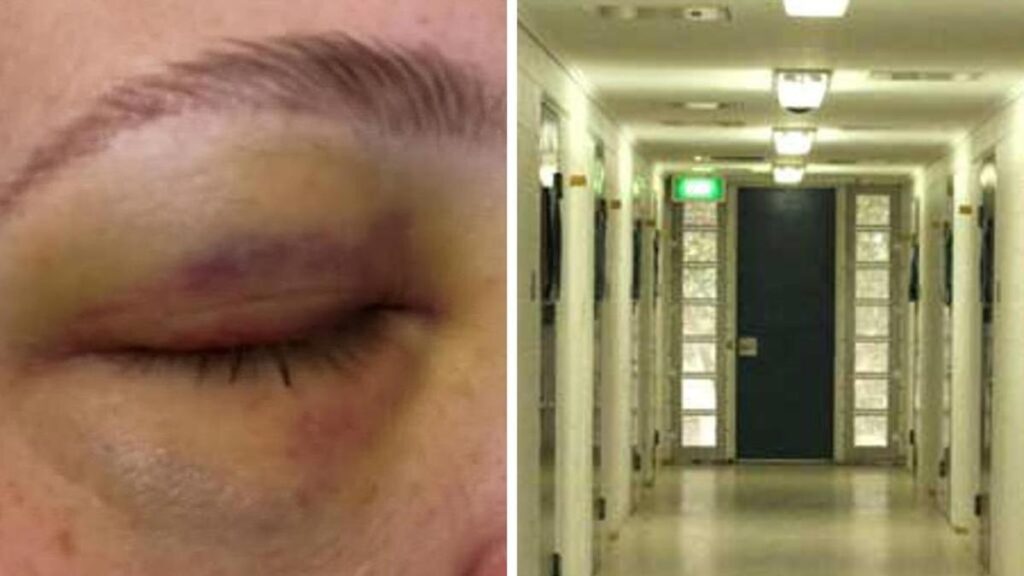 Queensland youth workers to stop work after staff allegedly assaulted, bit