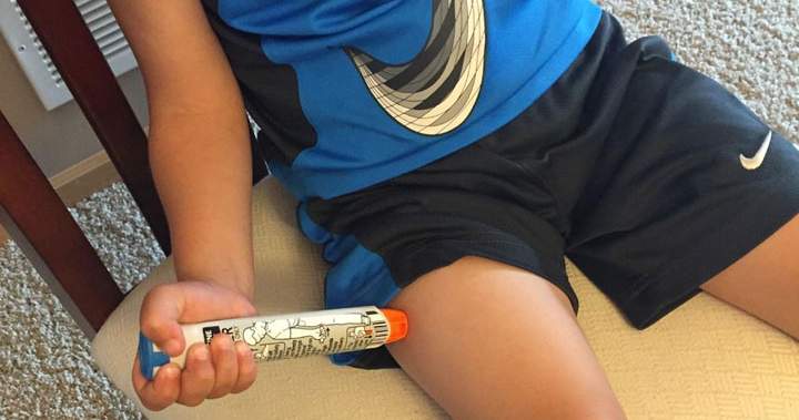 Food allergy education a must as kids head back to school, doctors say – National
